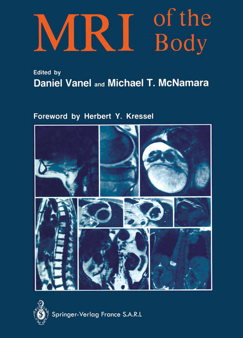 Book cover of MRI of the Body (1989)