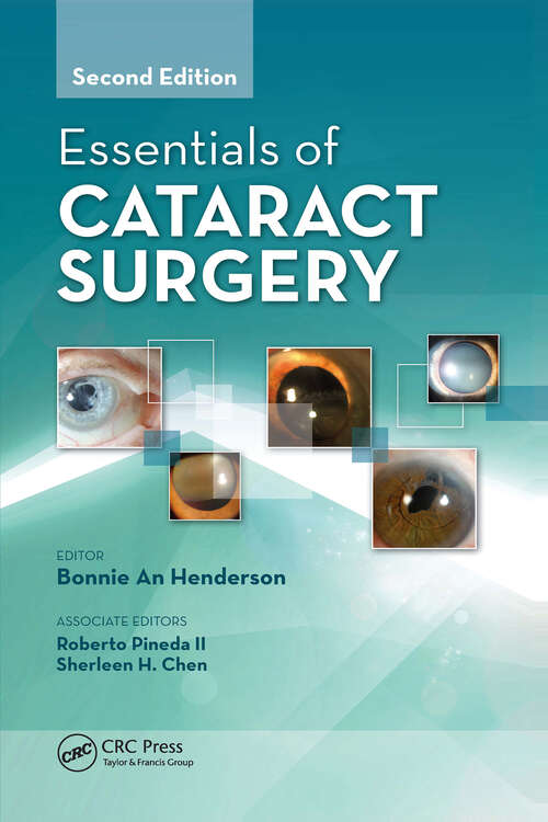 Book cover of Essentials of Cataract Surgery
