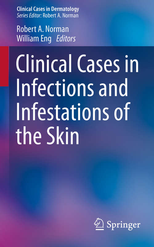 Book cover of Clinical Cases in Infections and Infestations of the Skin (2015) (Clinical Cases in Dermatology #6)