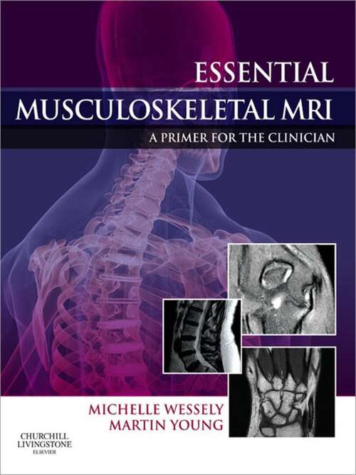 Book cover of Essential Musculoskeletal MRI E-Book: Essential Musculoskeletal MRI E-Book