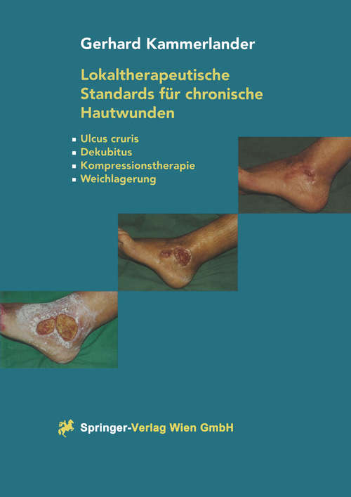 Book cover of Lokaltherapeutische Standards für chronische Hautwunden: Ulcus cruris - Dekubitus - Kompressionstherapie - Weichlagerung (1. Aufl. 1998)