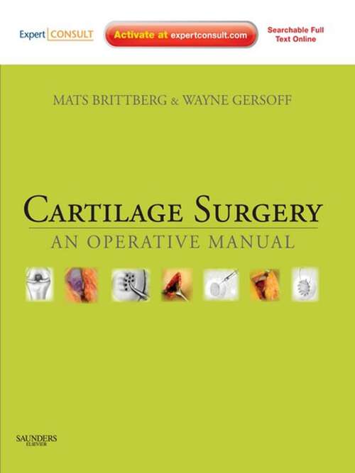 Book cover of Cartilage Surgery E-Book: An Operative Manual, with Expert Consult