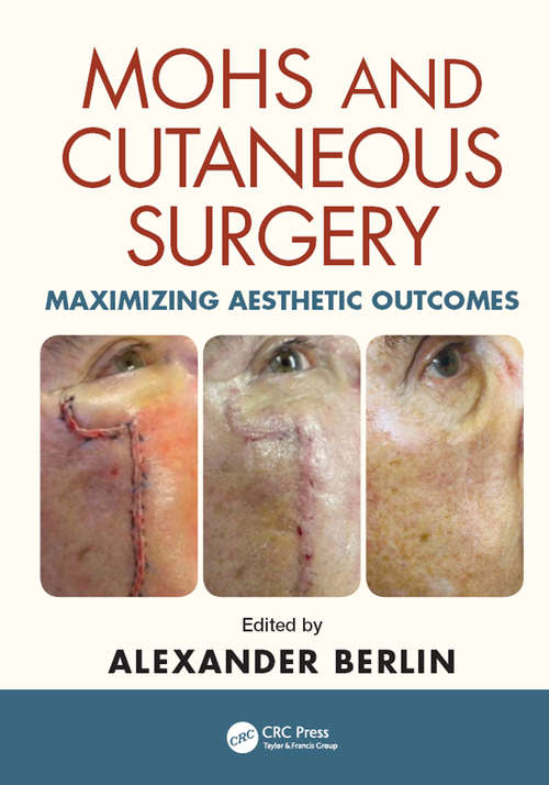 Book cover of Mohs and Cutaneous Surgery: Maximizing Aesthetic Outcomes