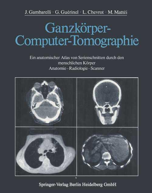 Book cover of Ganzkörper-Computer-Tomographie: Ein anatomischer Atlas von Serienschnitten durch den menschlichen Körper Anatomie — Radiologie — Scanner (1977)