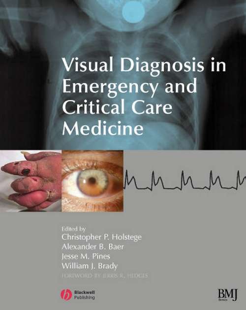 Book cover of Visual Diagnosis in Emergency and Critical Care Medicine