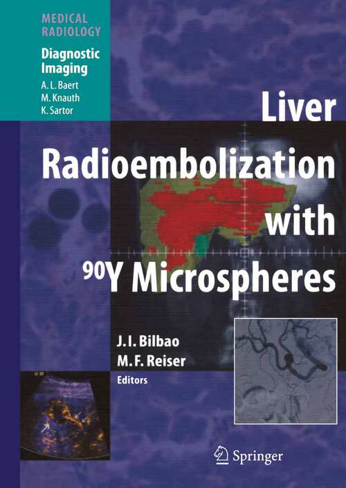 Book cover of Liver Radioembolization with 90Y Microspheres (2008) (Medical Radiology)