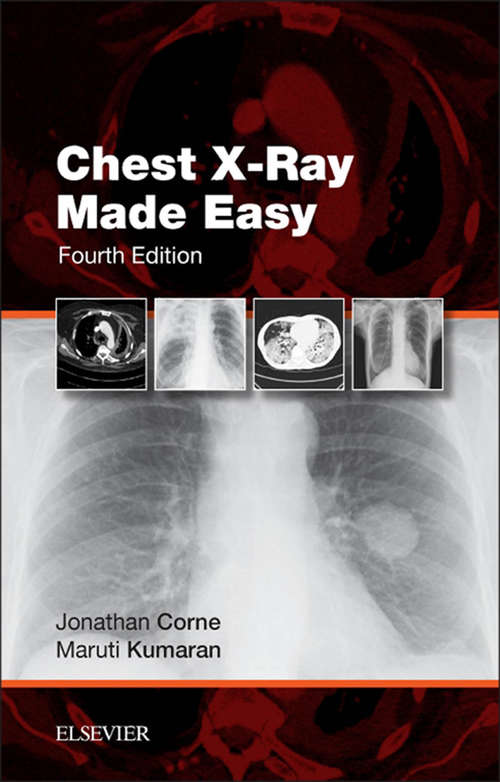 Book cover of Chest X-Ray Made Easy E-Book (3) (Made Easy)