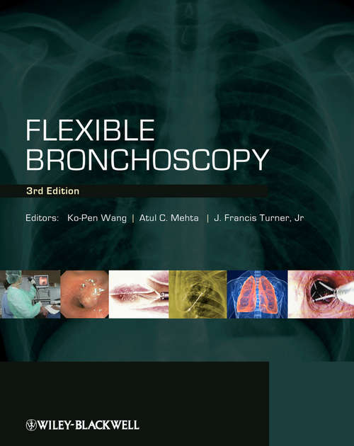 Book cover of Flexible Bronchoscopy (3)