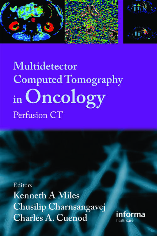 Book cover of Multi-Detector Computed Tomography in Oncology: CT Perfusion Imaging