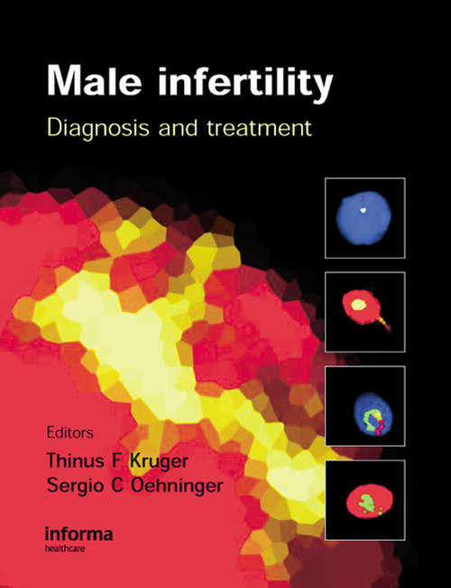 Book cover of Male Infertility: Diagnosis and Treatment
