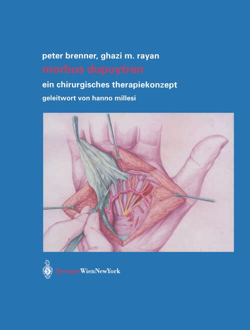 Book cover of Morbus Dupuytren: Ein chirurgisches Therapiekonzept (2003)