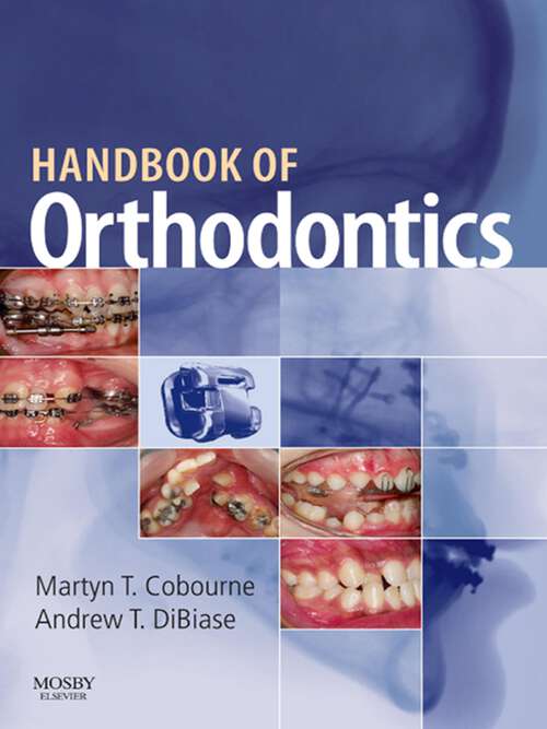 Book cover of Handbook of Orthodontics E-Book: Handbook of Orthodontics E-Book