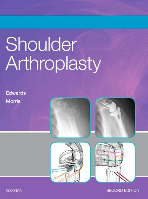 Book cover of Shoulder Arthroplasty E-Book (2)