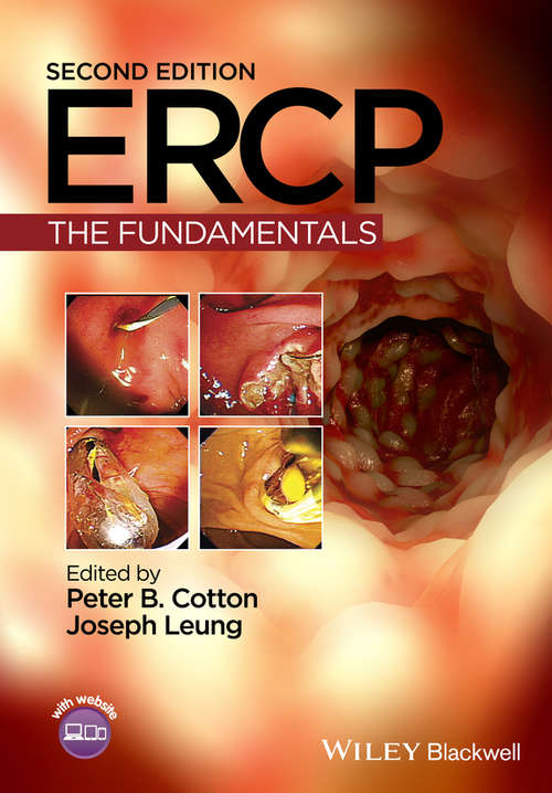 Book cover of ERCP: The Fundamentals (2)