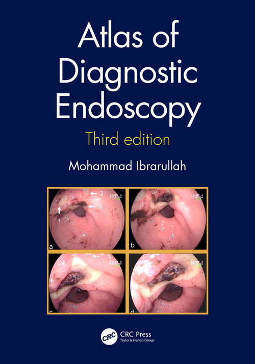 Book cover of Atlas of Diagnostic Endoscopy, 3E (3)