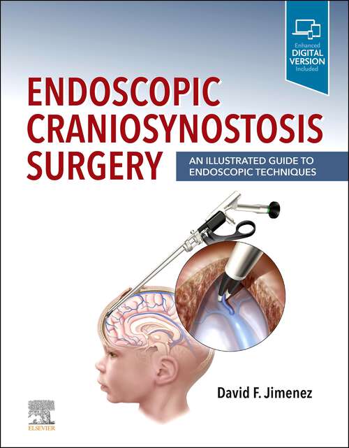 Book cover of Endoscopic Craniosynostosis Surgery E-Book: An Illustrated Guide to Endoscopic Techniques