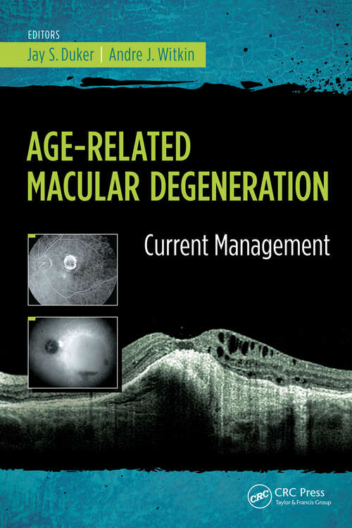 Book cover of Age-Related Macular Degeneration: Current Management