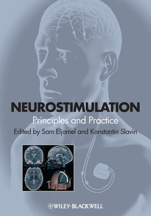 Book cover of Neurostimulation: Principles and Practice