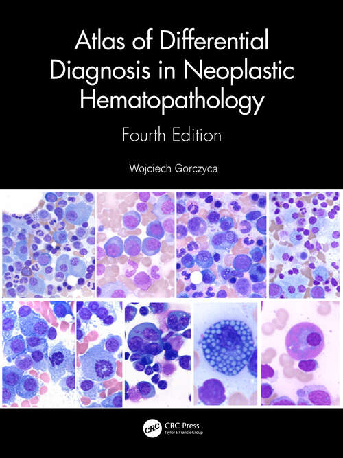 Book cover of Atlas of Differential Diagnosis in Neoplastic Hematopathology (4)