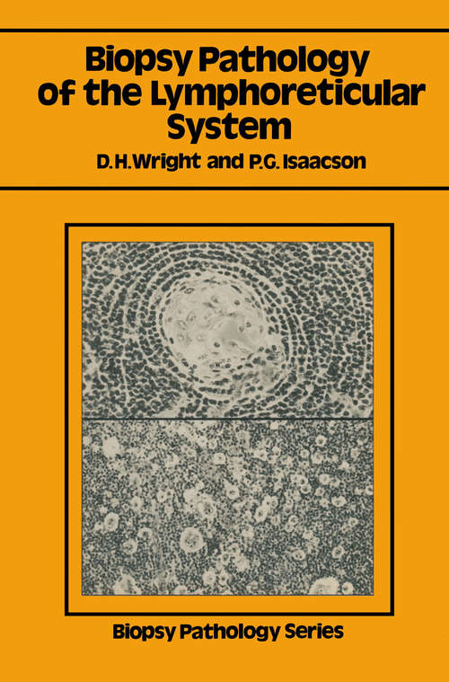 Book cover of Biopsy Pathology of the Lymphoreticular System (1983) (Biopsy Pathology Series)