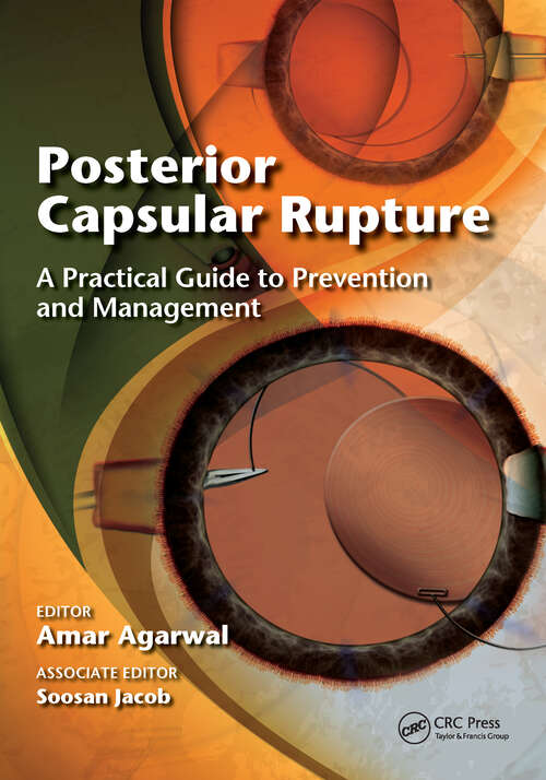 Book cover of Posterior Capsular Rupture: A Practical Guide to Prevention and Management