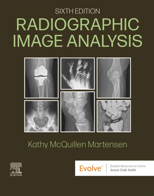 Book cover of Radiographic Image Analysis - E-Book: Radiographic Image Analysis - E-Book (6)