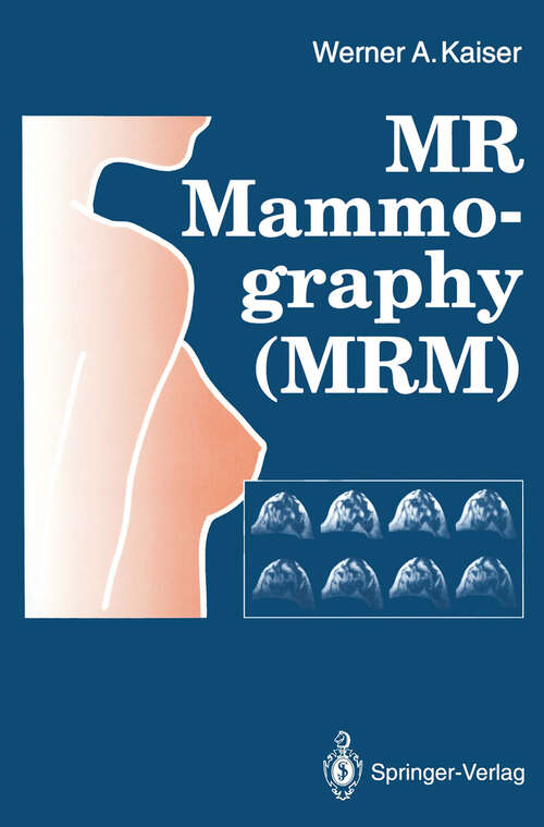 Book cover of MR Mammography (MRM) (1993)