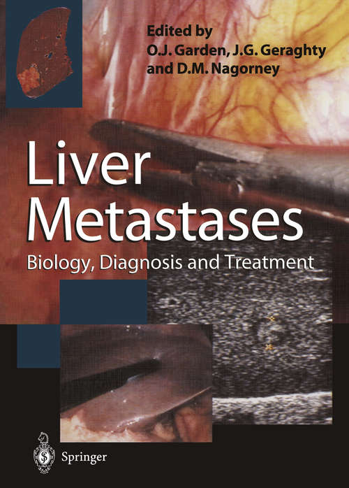 Book cover of Liver Metastases: Biology, Diagnosis and Treatment (1998)