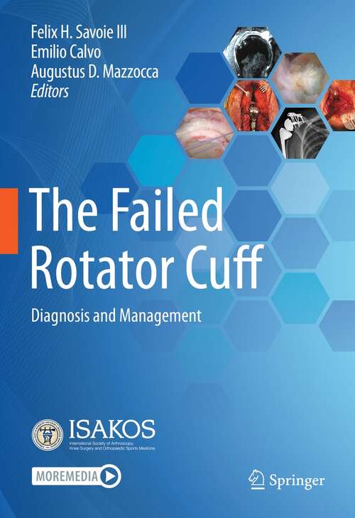 Book cover of The Failed Rotator Cuff: Diagnosis and Management (1st ed. 2021)