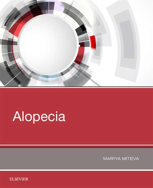 Book cover of Alopecia