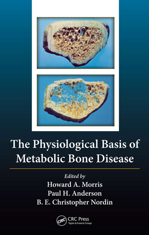 Book cover of The Physiological Basis of Metabolic Bone Disease