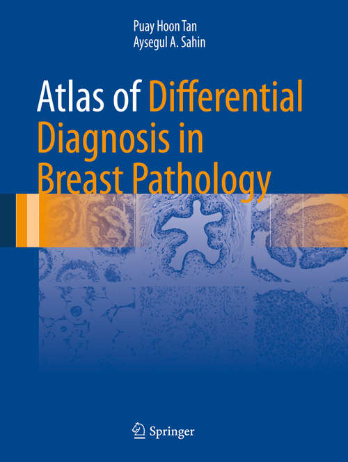 Book cover of Atlas of Differential Diagnosis in Breast Pathology (Atlas of Anatomic Pathology)
