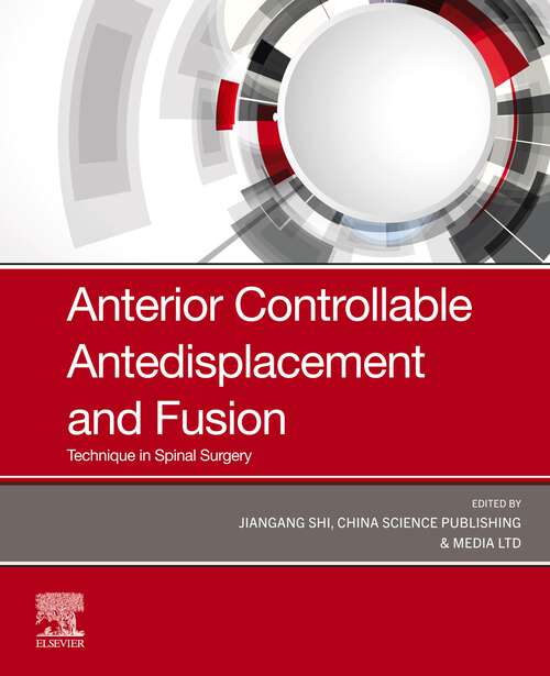 Book cover of Anterior Controllable Antedisplacement and Fusion (ACAF): Technique in Spinal Surgery