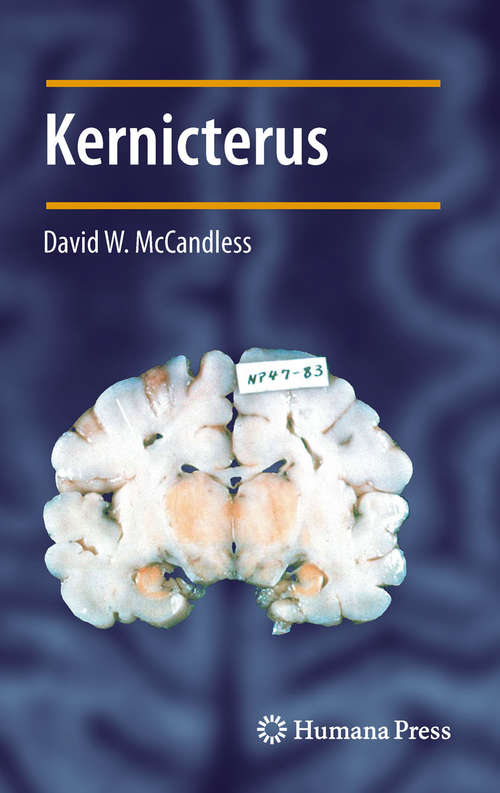 Book cover of Kernicterus (2011) (Contemporary Clinical Neuroscience)