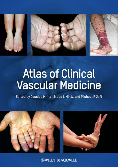 Book cover of Atlas of Clinical Vascular Medicine