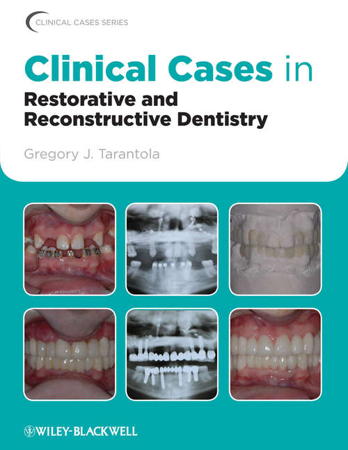 Book cover of Clinical Cases in Restorative and Reconstructive Dentistry (Clinical Cases (Dentistry))