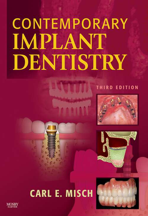 Book cover of Contemporary Implant Dentistry - E-Book: Contemporary Implant Dentistry - E-Book (3)