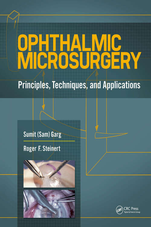 Book cover of Ophthalmic Microsurgery: Principles, Techniques, and Applications
