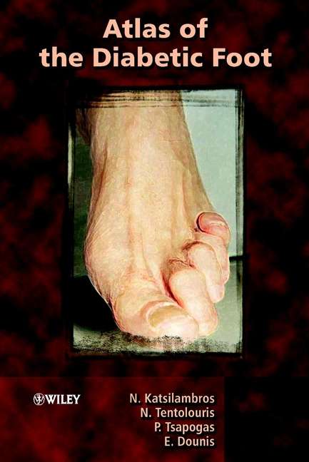 Book cover of Atlas of the Diabetic Foot