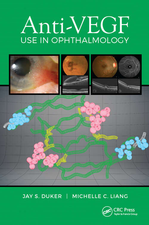 Book cover of Anti-VEGF Use in Ophthalmology