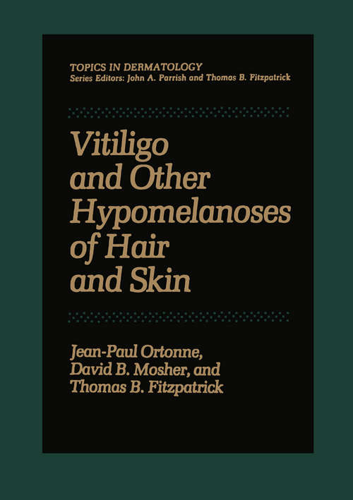 Book cover of Vitiligo and Other Hypomelanoses of Hair and Skin (1983) (Topics in Dermatology)
