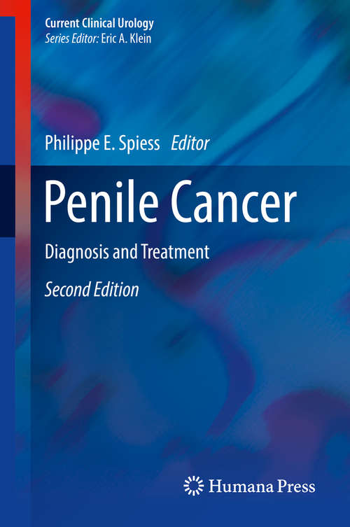 Book cover of Penile Cancer: Diagnosis and Treatment (Current Clinical Urology: 43-4)