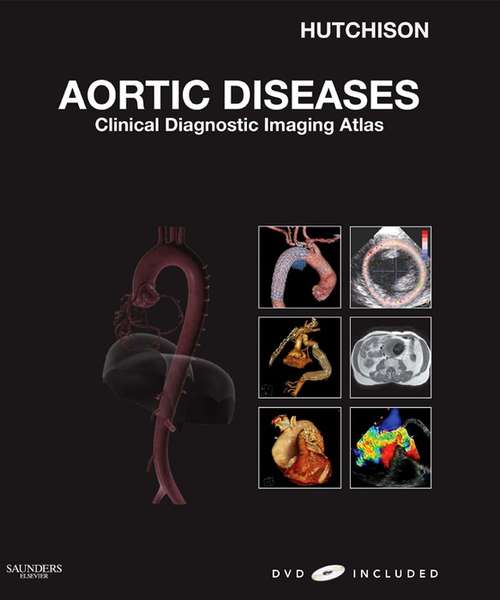 Book cover of Aortic Diseases E-Book: Clinical Diagnostic Imaging Atlas