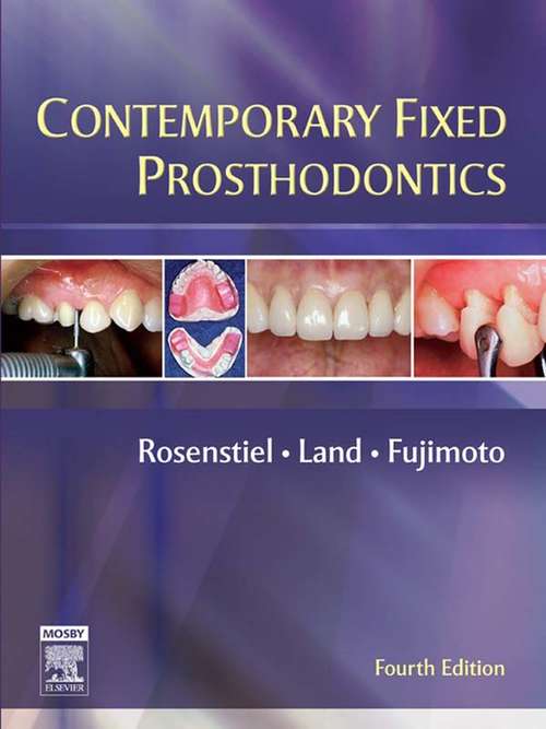 Book cover of ARABIC-Contemporary Fixed Prosthodontics