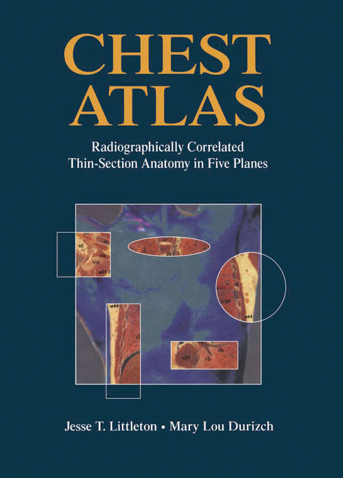 Book cover of Chest Atlas: Radiographically Correlated Thin-Section Anatomy in Five Planes (1994)