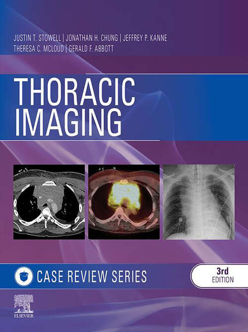 Book cover of Thoracic Imaging: Case Review Series E-Book (3) (Case Review)
