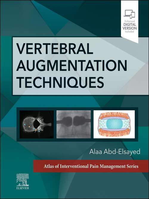 Book cover of Vertebral Augmentation Techniques: Vertebral Augmentation Techniques - E-Book (Atlas of Interventional Pain Management)
