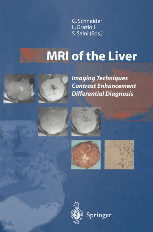 Book cover of MRI of the Liver: Imaging Techniques Contrast Enhancement Differential Diagnosis (2003)