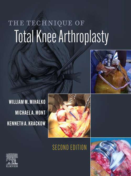 Book cover of The Technique of Total Knee Arthroplasty E-Book (2)