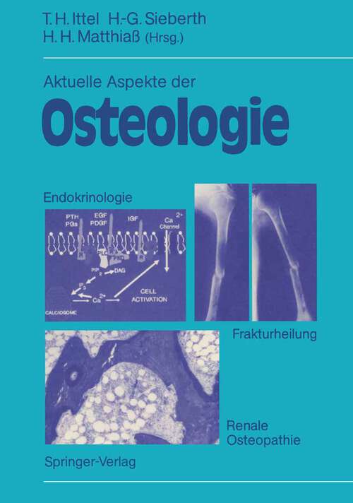 Book cover of Aktuelle Aspekte der Osteologie: Endokrinologie, Renale Osteopathie, Frakturheilung (1992)